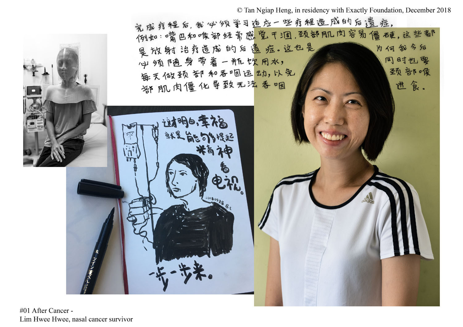 <p>After Cancer – Lim Hwee Hwee, nasal cancer survivor</p>
